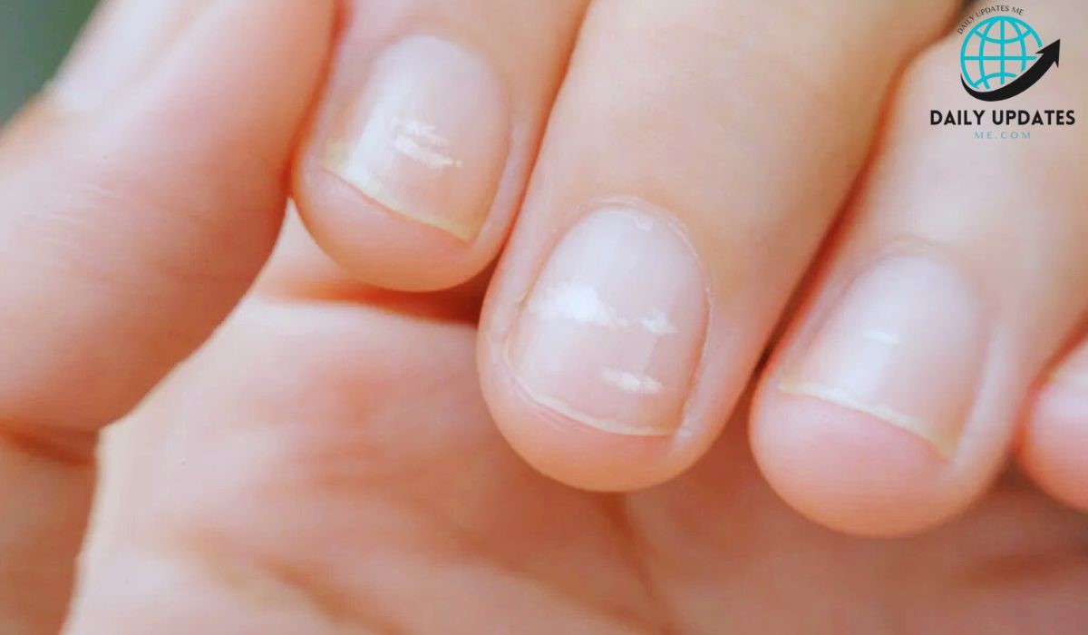 10 Common Nail Problems and How to Fix Them Naturally